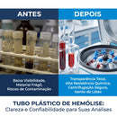 Tubo Plástico de Hemólise 12x75 PP 1000un - Tera Medical