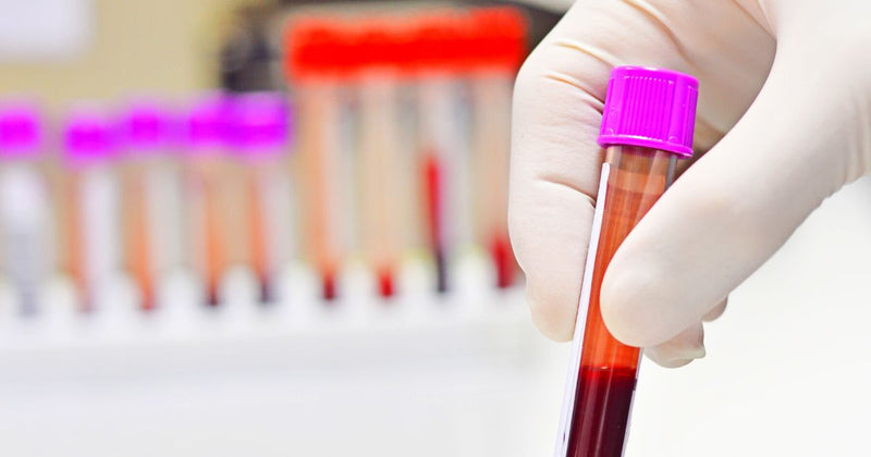 Tubo de Coleta de Sangue EDTA Roxo 100un - Labor Import