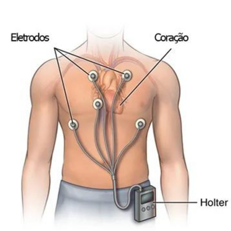 Eletrodo Para Monitoração Cardiaca 50un - Maxicor