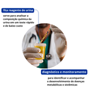 Tiras Para Urinálise 150un - Labor